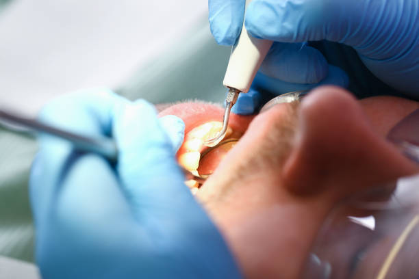 Best Emergency Dental Services for Seniors in Volo, IL