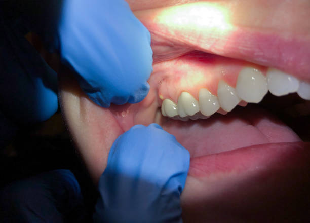 Best Orthodontic Emergency Dentist in Volo, IL